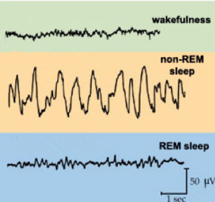 Sleep wave pattern