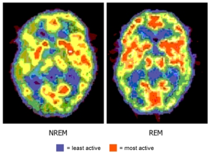 Our Brain During REM